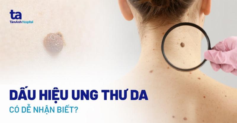 Hình ảnh minh họa quá trình tối ưu hóa SEO cho bài viết trên CPOPPING, bao gồm cả từ khóa vũ ngọc kim chi